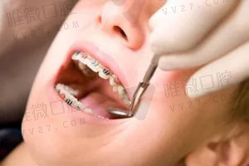 矫正牙齿的好处（一个牙医的良心正畸）(图1)